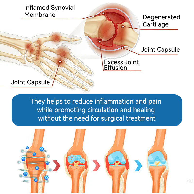 | Last Day Promotion 80% OFF | 🇺🇸 𝐂𝐫𝐨𝐚𝐢𝐞® BPC-157 Joint Healing Cream🦴Treats Arthritis. Neuropathy. Rheumatism. Sports Injuries & More🦵