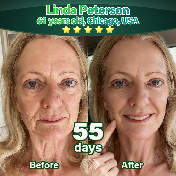 𝗗𝗲𝗲𝘃𝗼𝗼® 𝑺𝑡𝑒𝑚 𝑪𝑒𝑙𝑙 & 𝑪𝑜𝑙𝑙𝑎𝑔𝑒𝑛 𝑷𝑒𝑝𝑡𝑖𝑑𝑒 𝑶𝑟𝑎𝑙 𝑫𝑟𝑜𝑝𝑠 (𝑳𝑖𝑓𝑡 & 𝑭𝑖𝑟𝑚 𝑺𝑎𝑔𝑔𝑖𝑛𝑔 𝑺𝑘𝑖𝑛 & 𝑹𝑒𝑑𝑢𝑐𝑒 𝑾𝑟𝑖𝑛𝑘𝑙𝑒 𝑭𝑜𝑟𝑚𝑎𝑡𝑖𝑜𝑛) 💎