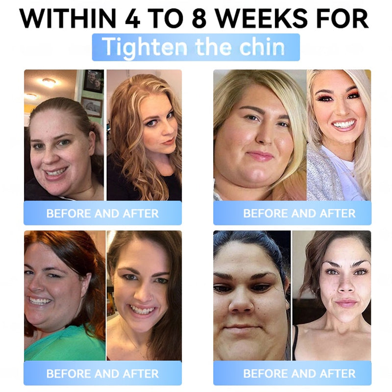 𝐅𝐃𝐀 𝐎𝐟𝐟𝐢𝐜𝐢𝐚𝐥 𝐒𝐭𝐨𝐫𝐞 | 𝐌𝐲𝐨 𝐂𝐥𝐢𝐧𝐢𝐜 𝐆𝐋𝐏-𝟏 𝐒𝐥𝐢𝐦 & 𝐅𝐢𝐫𝐦 𝐍𝐚𝐧𝐨 𝐌𝐢𝐜𝐫𝐨𝐧𝐞𝐞𝐝𝐥𝐞 𝐏𝐚𝐭𝐜𝐡 𝐰𝐢𝐭𝐡 𝐂𝐨𝐥𝐥𝐚𝐠𝐞𝐧, 𝐓𝐮𝐫𝐦𝐞𝐫𝐢𝐜 & 𝐌𝐚𝐭𝐫𝐢𝐱𝐲𝐥 𝟑𝟎𝟎𝟎丨𝐎𝐛𝐞𝐬𝐢𝐭𝐲, 𝐂𝐚𝐫𝐝𝐢𝐨𝐯𝐚𝐬𝐜𝐮𝐥𝐚𝐫 𝐃𝐢𝐬𝐞𝐚𝐬𝐞, 𝐃𝐢𝐚𝐛𝐞𝐭𝐞𝐬, 𝐒𝐥𝐞𝐞𝐩 𝐀𝐩𝐧𝐞𝐚, 𝐉𝐨𝐢𝐧𝐭 𝐏𝐫𝐨𝐛𝐥𝐞𝐦𝐬 𝐚𝐧𝐝 𝐌𝐨𝐫𝐞 (𝐂𝐨𝐩𝐲)