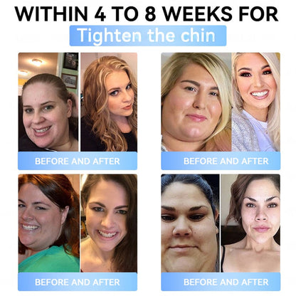 𝐅𝐃𝐀 𝐎𝐟𝐟𝐢𝐜𝐢𝐚𝐥 𝐒𝐭𝐨𝐫𝐞 | 𝐌𝐲𝐨 𝐂𝐥𝐢𝐧𝐢𝐜 𝐆𝐋𝐏-𝟏 𝐒𝐥𝐢𝐦 & 𝐅𝐢𝐫𝐦 𝐍𝐚𝐧𝐨 𝐌𝐢𝐜𝐫𝐨𝐧𝐞𝐞𝐝𝐥𝐞 𝐏𝐚𝐭𝐜𝐡 𝐰𝐢𝐭𝐡 𝐂𝐨𝐥𝐥𝐚𝐠𝐞𝐧, 𝐓𝐮𝐫𝐦𝐞𝐫𝐢𝐜 & 𝐌𝐚𝐭𝐫𝐢𝐱𝐲𝐥 𝟑𝟎𝟎𝟎丨𝐎𝐛𝐞𝐬𝐢𝐭𝐲, 𝐂𝐚𝐫𝐝𝐢𝐨𝐯𝐚𝐬𝐜𝐮𝐥𝐚𝐫 𝐃𝐢𝐬𝐞𝐚𝐬𝐞, 𝐃𝐢𝐚𝐛𝐞𝐭𝐞𝐬, 𝐒𝐥𝐞𝐞𝐩 𝐀𝐩𝐧𝐞𝐚, 𝐉𝐨𝐢𝐧𝐭 𝐏𝐫𝐨𝐛𝐥𝐞𝐦𝐬 𝐚𝐧𝐝 𝐌𝐨𝐫𝐞 (𝐂𝐨𝐩𝐲)