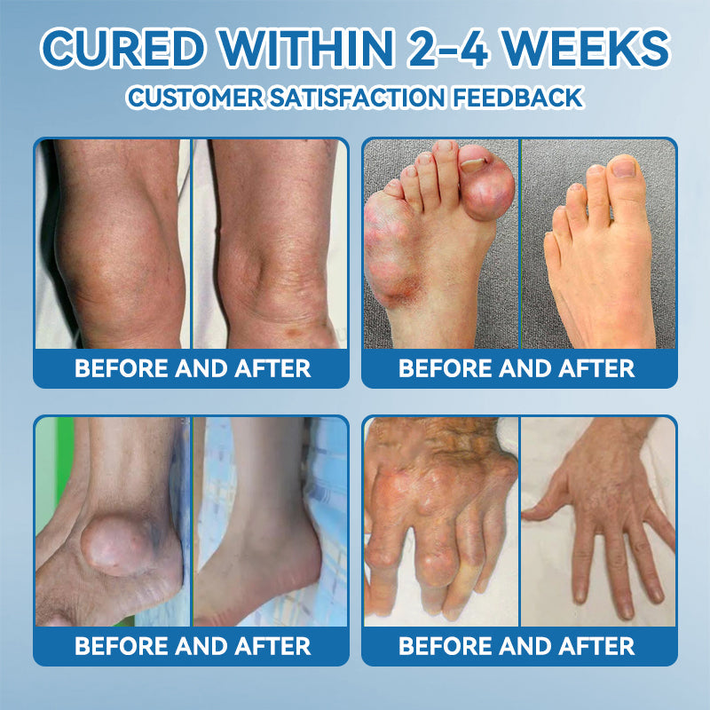 | Last Day Promotion 80% OFF | 🇺🇸 𝐂𝐫𝐨𝐚𝐢𝐞® BPC-157 Joint Healing Cream🦴Treats Arthritis. Neuropathy. Rheumatism. Sports Injuries & More🦵