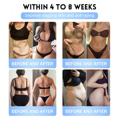 𝐅𝐃𝐀 𝐎𝐟𝐟𝐢𝐜𝐢𝐚𝐥 𝐒𝐭𝐨𝐫𝐞 | 𝐌𝐲𝐨 𝐂𝐥𝐢𝐧𝐢𝐜 𝐆𝐋𝐏-𝟏 𝐒𝐥𝐢𝐦 & 𝐅𝐢𝐫𝐦 𝐍𝐚𝐧𝐨 𝐌𝐢𝐜𝐫𝐨𝐧𝐞𝐞𝐝𝐥𝐞 𝐏𝐚𝐭𝐜𝐡 𝐰𝐢𝐭𝐡 𝐂𝐨𝐥𝐥𝐚𝐠𝐞𝐧, 𝐓𝐮𝐫𝐦𝐞𝐫𝐢𝐜 & 𝐌𝐚𝐭𝐫𝐢𝐱𝐲𝐥 𝟑𝟎𝟎𝟎丨𝐎𝐛𝐞𝐬𝐢𝐭𝐲, 𝐂𝐚𝐫𝐝𝐢𝐨𝐯𝐚𝐬𝐜𝐮𝐥𝐚𝐫 𝐃𝐢𝐬𝐞𝐚𝐬𝐞, 𝐃𝐢𝐚𝐛𝐞𝐭𝐞𝐬, 𝐒𝐥𝐞𝐞𝐩 𝐀𝐩𝐧𝐞𝐚, 𝐉𝐨𝐢𝐧𝐭 𝐏𝐫𝐨𝐛𝐥𝐞𝐦𝐬 𝐚𝐧𝐝 𝐌𝐨𝐫𝐞 (𝐂𝐨𝐩𝐲)