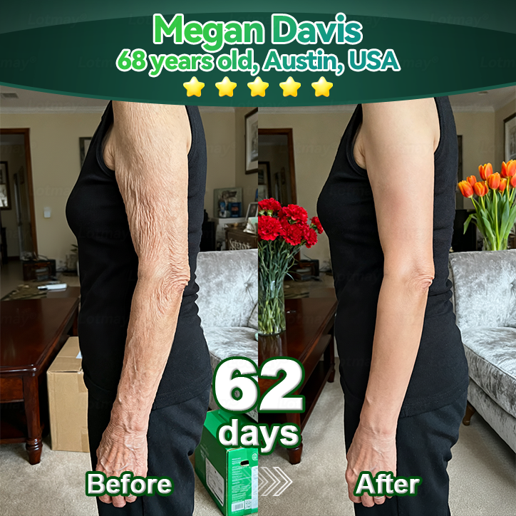 𝗗𝗲𝗲𝘃𝗼𝗼® 𝑺𝑡𝑒𝑚 𝑪𝑒𝑙𝑙 & 𝑪𝑜𝑙𝑙𝑎𝑔𝑒𝑛 𝑷𝑒𝑝𝑡𝑖𝑑𝑒 𝑶𝑟𝑎𝑙 𝑫𝑟𝑜𝑝𝑠 (𝑳𝑖𝑓𝑡 & 𝑭𝑖𝑟𝑚 𝑺𝑎𝑔𝑔𝑖𝑛𝑔 𝑺𝑘𝑖𝑛 & 𝑹𝑒𝑑𝑢𝑐𝑒 𝑾𝑟𝑖𝑛𝑘𝑙𝑒 𝑭𝑜𝑟𝑚𝑎𝑡𝑖𝑜𝑛) 💎
