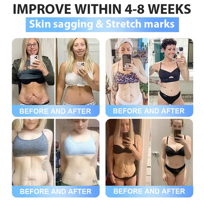 𝐅𝐃𝐀 𝐎𝐟𝐟𝐢𝐜𝐢𝐚𝐥 𝐒𝐭𝐨𝐫𝐞 | 𝐌𝐲𝐨 𝐂𝐥𝐢𝐧𝐢𝐜 𝐆𝐋𝐏-𝟏 𝐒𝐥𝐢𝐦 & 𝐅𝐢𝐫𝐦 𝐍𝐚𝐧𝐨 𝐌𝐢𝐜𝐫𝐨𝐧𝐞𝐞𝐝𝐥𝐞 𝐏𝐚𝐭𝐜𝐡 𝐰𝐢𝐭𝐡 𝐂𝐨𝐥𝐥𝐚𝐠𝐞𝐧, 𝐓𝐮𝐫𝐦𝐞𝐫𝐢𝐜 & 𝐌𝐚𝐭𝐫𝐢𝐱𝐲𝐥 𝟑𝟎𝟎𝟎丨𝐎𝐛𝐞𝐬𝐢𝐭𝐲, 𝐂𝐚𝐫𝐝𝐢𝐨𝐯𝐚𝐬𝐜𝐮𝐥𝐚𝐫 𝐃𝐢𝐬𝐞𝐚𝐬𝐞, 𝐃𝐢𝐚𝐛𝐞𝐭𝐞𝐬, 𝐒𝐥𝐞𝐞𝐩 𝐀𝐩𝐧𝐞𝐚, 𝐉𝐨𝐢𝐧𝐭 𝐏𝐫𝐨𝐛𝐥𝐞𝐦𝐬 𝐚𝐧𝐝 𝐌𝐨𝐫𝐞 (𝐂𝐨𝐩𝐲)