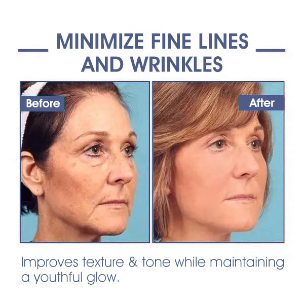 ⭐ Unwrap the Savings! Fubsta® Firming Cream Christmas Special: Take 75% OFF! 🎁