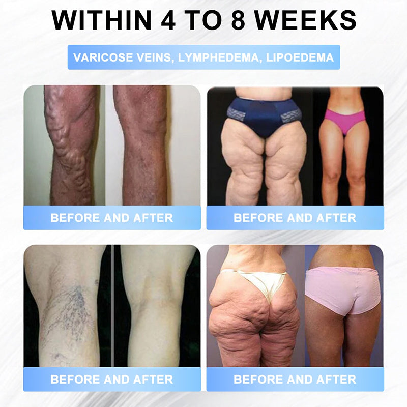 𝐅𝐃𝐀 𝐎𝐟𝐟𝐢𝐜𝐢𝐚𝐥 𝐒𝐭𝐨𝐫𝐞 | 𝐌𝐲𝐨 𝐂𝐥𝐢𝐧𝐢𝐜 𝐆𝐋𝐏-𝟏 𝐒𝐥𝐢𝐦 & 𝐅𝐢𝐫𝐦 𝐍𝐚𝐧𝐨 𝐌𝐢𝐜𝐫𝐨𝐧𝐞𝐞𝐝𝐥𝐞 𝐏𝐚𝐭𝐜𝐡 𝐰𝐢𝐭𝐡 𝐂𝐨𝐥𝐥𝐚𝐠𝐞𝐧, 𝐓𝐮𝐫𝐦𝐞𝐫𝐢𝐜 & 𝐌𝐚𝐭𝐫𝐢𝐱𝐲𝐥 𝟑𝟎𝟎𝟎丨𝐎𝐛𝐞𝐬𝐢𝐭𝐲, 𝐂𝐚𝐫𝐝𝐢𝐨𝐯𝐚𝐬𝐜𝐮𝐥𝐚𝐫 𝐃𝐢𝐬𝐞𝐚𝐬𝐞, 𝐃𝐢𝐚𝐛𝐞𝐭𝐞𝐬, 𝐒𝐥𝐞𝐞𝐩 𝐀𝐩𝐧𝐞𝐚, 𝐉𝐨𝐢𝐧𝐭 𝐏𝐫𝐨𝐛𝐥𝐞𝐦𝐬 𝐚𝐧𝐝 𝐌𝐨𝐫𝐞 (𝐂𝐨𝐩𝐲)