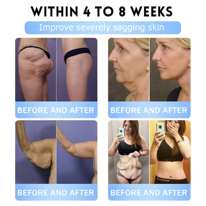 𝐅𝐃𝐀 𝐎𝐟𝐟𝐢𝐜𝐢𝐚𝐥 𝐒𝐭𝐨𝐫𝐞 | 𝐌𝐲𝐨 𝐂𝐥𝐢𝐧𝐢𝐜 𝐆𝐋𝐏-𝟏 𝐒𝐥𝐢𝐦 & 𝐅𝐢𝐫𝐦 𝐍𝐚𝐧𝐨 𝐌𝐢𝐜𝐫𝐨𝐧𝐞𝐞𝐝𝐥𝐞 𝐏𝐚𝐭𝐜𝐡 𝐰𝐢𝐭𝐡 𝐂𝐨𝐥𝐥𝐚𝐠𝐞𝐧, 𝐓𝐮𝐫𝐦𝐞𝐫𝐢𝐜 & 𝐌𝐚𝐭𝐫𝐢𝐱𝐲𝐥 𝟑𝟎𝟎𝟎丨𝐎𝐛𝐞𝐬𝐢𝐭𝐲, 𝐂𝐚𝐫𝐝𝐢𝐨𝐯𝐚𝐬𝐜𝐮𝐥𝐚𝐫 𝐃𝐢𝐬𝐞𝐚𝐬𝐞, 𝐃𝐢𝐚𝐛𝐞𝐭𝐞𝐬, 𝐒𝐥𝐞𝐞𝐩 𝐀𝐩𝐧𝐞𝐚, 𝐉𝐨𝐢𝐧𝐭 𝐏𝐫𝐨𝐛𝐥𝐞𝐦𝐬 𝐚𝐧𝐝 𝐌𝐨𝐫𝐞 (𝐂𝐨𝐩𝐲)