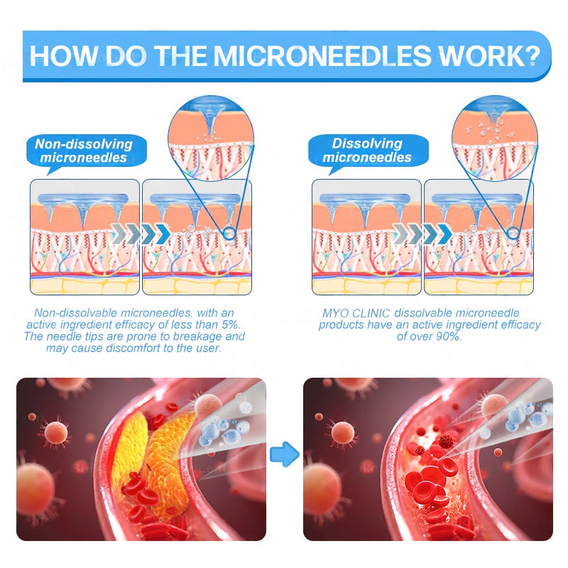 𝐅𝐃𝐀 𝐎𝐟𝐟𝐢𝐜𝐢𝐚𝐥 𝐒𝐭𝐨𝐫𝐞 | 𝐌𝐲𝐨 𝐂𝐥𝐢𝐧𝐢𝐜 𝐆𝐋𝐏-𝟏 𝐒𝐥𝐢𝐦 & 𝐅𝐢𝐫𝐦 𝐍𝐚𝐧𝐨 𝐌𝐢𝐜𝐫𝐨𝐧𝐞𝐞𝐝𝐥𝐞 𝐏𝐚𝐭𝐜𝐡 𝐰𝐢𝐭𝐡 𝐂𝐨𝐥𝐥𝐚𝐠𝐞𝐧, 𝐓𝐮𝐫𝐦𝐞𝐫𝐢𝐜 & 𝐌𝐚𝐭𝐫𝐢𝐱𝐲𝐥 𝟑𝟎𝟎𝟎丨𝐎𝐛𝐞𝐬𝐢𝐭𝐲, 𝐂𝐚𝐫𝐝𝐢𝐨𝐯𝐚𝐬𝐜𝐮𝐥𝐚𝐫 𝐃𝐢𝐬𝐞𝐚𝐬𝐞, 𝐃𝐢𝐚𝐛𝐞𝐭𝐞𝐬, 𝐒𝐥𝐞𝐞𝐩 𝐀𝐩𝐧𝐞𝐚, 𝐉𝐨𝐢𝐧𝐭 𝐏𝐫𝐨𝐛𝐥𝐞𝐦𝐬 𝐚𝐧𝐝 𝐌𝐨𝐫𝐞 (𝐂𝐨𝐩𝐲)