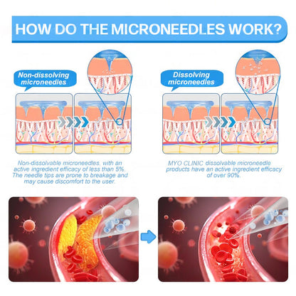 𝐅𝐃𝐀 𝐎𝐟𝐟𝐢𝐜𝐢𝐚𝐥 𝐒𝐭𝐨𝐫𝐞 | 𝐌𝐲𝐨 𝐂𝐥𝐢𝐧𝐢𝐜 𝐆𝐋𝐏-𝟏 𝐒𝐥𝐢𝐦 & 𝐅𝐢𝐫𝐦 𝐍𝐚𝐧𝐨 𝐌𝐢𝐜𝐫𝐨𝐧𝐞𝐞𝐝𝐥𝐞 𝐏𝐚𝐭𝐜𝐡 𝐰𝐢𝐭𝐡 𝐂𝐨𝐥𝐥𝐚𝐠𝐞𝐧, 𝐓𝐮𝐫𝐦𝐞𝐫𝐢𝐜 & 𝐌𝐚𝐭𝐫𝐢𝐱𝐲𝐥 𝟑𝟎𝟎𝟎丨𝐎𝐛𝐞𝐬𝐢𝐭𝐲, 𝐂𝐚𝐫𝐝𝐢𝐨𝐯𝐚𝐬𝐜𝐮𝐥𝐚𝐫 𝐃𝐢𝐬𝐞𝐚𝐬𝐞, 𝐃𝐢𝐚𝐛𝐞𝐭𝐞𝐬, 𝐒𝐥𝐞𝐞𝐩 𝐀𝐩𝐧𝐞𝐚, 𝐉𝐨𝐢𝐧𝐭 𝐏𝐫𝐨𝐛𝐥𝐞𝐦𝐬 𝐚𝐧𝐝 𝐌𝐨𝐫𝐞 (𝐂𝐨𝐩𝐲)