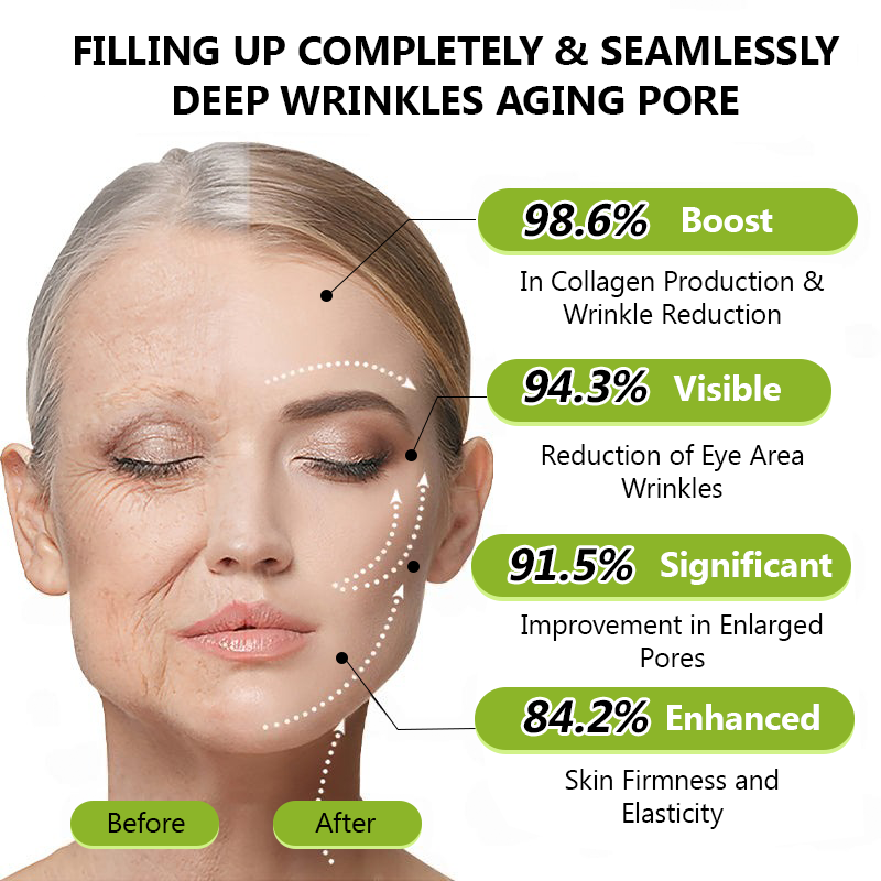 Official Store | Rejuvenate Your Skin Instantly 💫 STDEI® BOTOX & VITA A RETINOL SHOT Anti-Wrinkle Lifting & Firming Cream