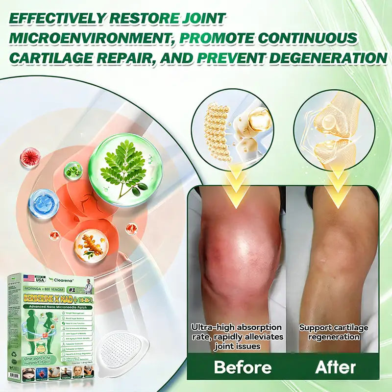 🇺🇸 𝐎𝐟𝐟𝐢𝐜𝐢𝐚𝐥 𝐔𝐒 𝐒𝐭𝐨𝐫𝐞 | 🧑‍⚕️🩺 𝘾𝙡𝙚𝙖𝙧𝙚𝙣𝙖® Moringa · Berberine × NAD+ 10-𝐢𝐧-𝟏 𝐀𝐝𝐯𝐚𝐧𝐜𝐞𝐝 𝐍𝐚𝐧𝐨 𝐌𝐢𝐜𝐫𝐨𝐧𝐞𝐞𝐝𝐥𝐞 𝐏𝐚𝐭𝐜𝐡 — 𝐎𝐧𝐜𝐞 𝐃𝐚𝐢𝐥𝐲, 𝐕𝐢𝐬𝐢𝐛𝐥𝐞 𝐑𝐞𝐬𝐮𝐥𝐭𝐬 𝐢𝐧 𝟕 𝐃𝐚𝐲𝐬