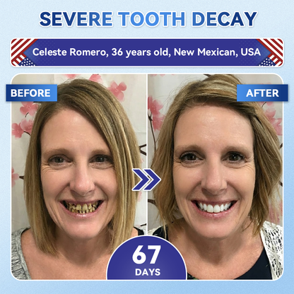 【𝐎𝐟𝐟𝐢𝐜𝐢𝐚𝐥 𝐔𝐒 𝐒𝐭𝐨𝐫𝐞  】ZUEET® 🦷 Tideglusib Fast‑Dissolving Tooth & Gum Repair Oral Strips ✨ (Supports tooth repair and helps relieve gum discomfort and other common oral concerns)