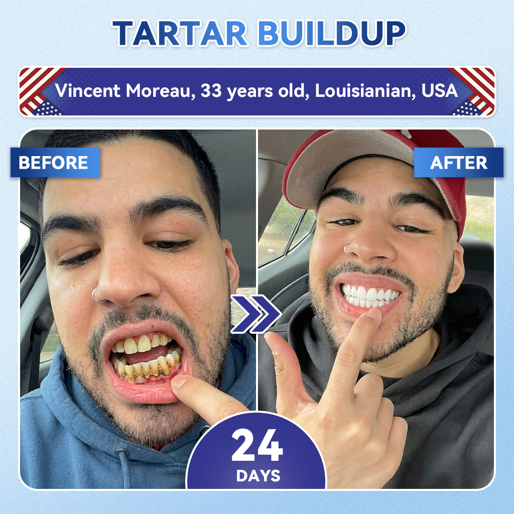 【𝐎𝐟𝐟𝐢𝐜𝐢𝐚𝐥 𝐔𝐒 𝐒𝐭𝐨𝐫𝐞  】ZUEET® 🦷 Tideglusib Fast‑Dissolving Tooth & Gum Repair Oral Strips ✨ (Supports tooth repair and helps relieve gum discomfort and other common oral concerns)