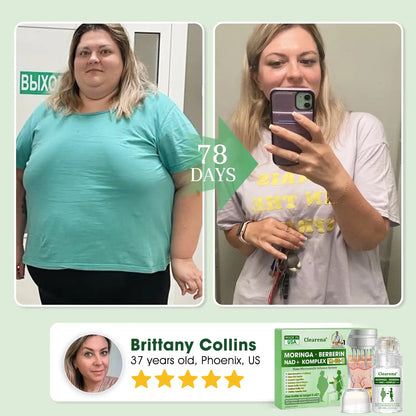 Official Store | ✔️ 𝐂𝐥𝐞𝐚𝐫𝐞𝐧𝐚® Nano Microneedle Infusion System🔬 – Moringa · Berberine + NAD+ 12-in-1 Metabolic Complex (300% Deeper Absorption, Once Daily, Visible Changes in 7 Days)