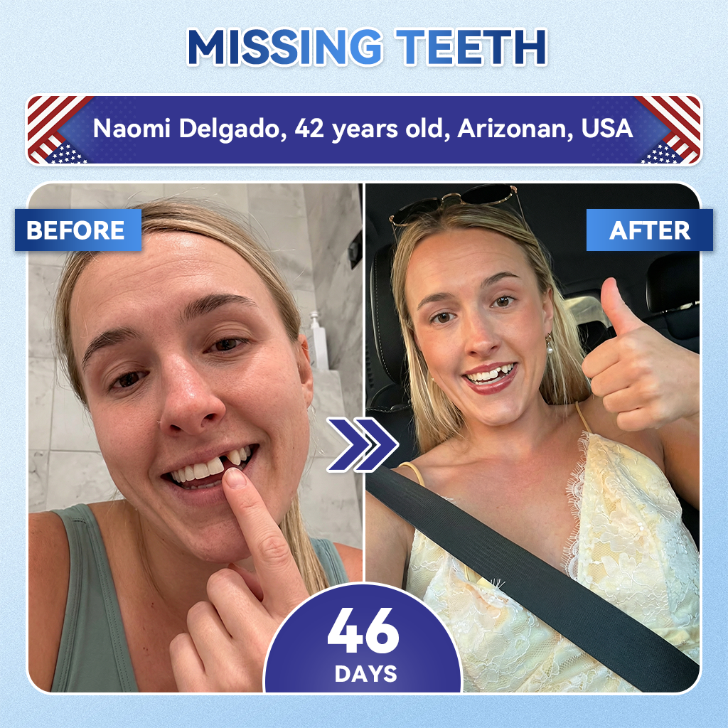 【𝐎𝐟𝐟𝐢𝐜𝐢𝐚𝐥 𝐔𝐒 𝐒𝐭𝐨𝐫𝐞  】ZUEET® 🦷 Tideglusib Fast‑Dissolving Tooth & Gum Repair Oral Strips ✨ (Supports tooth repair and helps relieve gum discomfort and other common oral concerns)