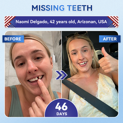 【𝐎𝐟𝐟𝐢𝐜𝐢𝐚𝐥 𝐔𝐒 𝐒𝐭𝐨𝐫𝐞  】ZUEET® 🦷 Tideglusib Fast‑Dissolving Tooth & Gum Repair Oral Strips ✨ (Supports tooth repair and helps relieve gum discomfort and other common oral concerns)