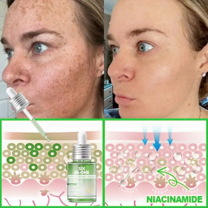 𝐎𝐫𝐢𝐚𝐜𝐡® 𝐀𝟏𝟎+ 𝟔-𝐢𝐧-𝟏 𝐃𝐞𝐫𝐦𝐚𝐑𝐞𝐩𝐚𝐢𝐫 𝐒𝐞𝐫𝐮𝐦 💧 𝐅𝐃𝐀 𝐂𝐞𝐫𝐭𝐢𝐟𝐢𝐞𝐝 🇺🇸 – 𝐅𝐢𝐫𝐦𝐬 𝐥𝐨𝐨𝐬𝐞 𝐬𝐤𝐢𝐧 💪, 𝐟𝐚𝐝𝐞𝐬 𝐛𝐫𝐮𝐢𝐬𝐢𝐧𝐠 💜 𝐚𝐧𝐝 𝐬𝐞𝐧𝐢𝐥𝐞 𝐩𝐮𝐫𝐩𝐮𝐫𝐚, 𝐚𝐧𝐝 𝐢𝐦𝐩𝐫𝐨𝐯𝐞𝐬 𝐤𝐞𝐫𝐚𝐭𝐢𝐧 𝐛𝐮𝐢𝐥𝐝𝐮𝐩, 𝐬𝐞𝐛𝐨𝐫𝐫𝐡𝐞𝐢𝐜 𝐝𝐞𝐫𝐦𝐚𝐭𝐢𝐭𝐢𝐬, 𝐚𝐧𝐝 𝐟𝐨𝐥𝐥𝐢𝐜𝐮𝐥𝐚𝐫 𝐤𝐞𝐫𝐚𝐭𝐨𝐬𝐢𝐬 ✨