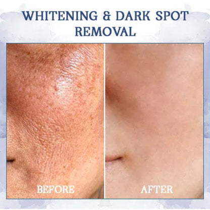 ⭐ Unwrap the Savings! Fubsta® Firming Cream Christmas Special: Take 75% OFF! 🎁