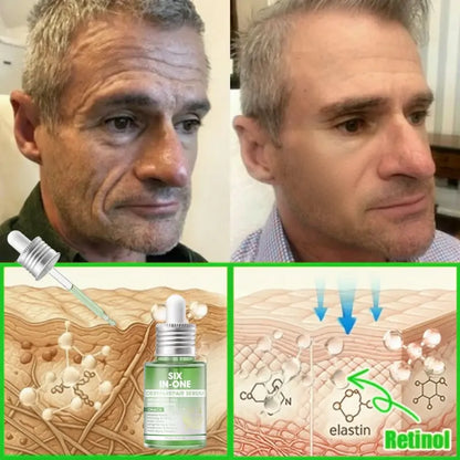 𝐎𝐫𝐢𝐚𝐜𝐡® 𝐀𝟏𝟎+ 𝟔-𝐢𝐧-𝟏 𝐃𝐞𝐫𝐦𝐚𝐑𝐞𝐩𝐚𝐢𝐫 𝐒𝐞𝐫𝐮𝐦 💧 𝐅𝐃𝐀 𝐂𝐞𝐫𝐭𝐢𝐟𝐢𝐞𝐝 🇺🇸 – 𝐅𝐢𝐫𝐦𝐬 𝐥𝐨𝐨𝐬𝐞 𝐬𝐤𝐢𝐧 💪, 𝐟𝐚𝐝𝐞𝐬 𝐛𝐫𝐮𝐢𝐬𝐢𝐧𝐠 💜 𝐚𝐧𝐝 𝐬𝐞𝐧𝐢𝐥𝐞 𝐩𝐮𝐫𝐩𝐮𝐫𝐚, 𝐚𝐧𝐝 𝐢𝐦𝐩𝐫𝐨𝐯𝐞𝐬 𝐤𝐞𝐫𝐚𝐭𝐢𝐧 𝐛𝐮𝐢𝐥𝐝𝐮𝐩, 𝐬𝐞𝐛𝐨𝐫𝐫𝐡𝐞𝐢𝐜 𝐝𝐞𝐫𝐦𝐚𝐭𝐢𝐭𝐢𝐬, 𝐚𝐧𝐝 𝐟𝐨𝐥𝐥𝐢𝐜𝐮𝐥𝐚𝐫 𝐤𝐞𝐫𝐚𝐭𝐨𝐬𝐢𝐬 ✨