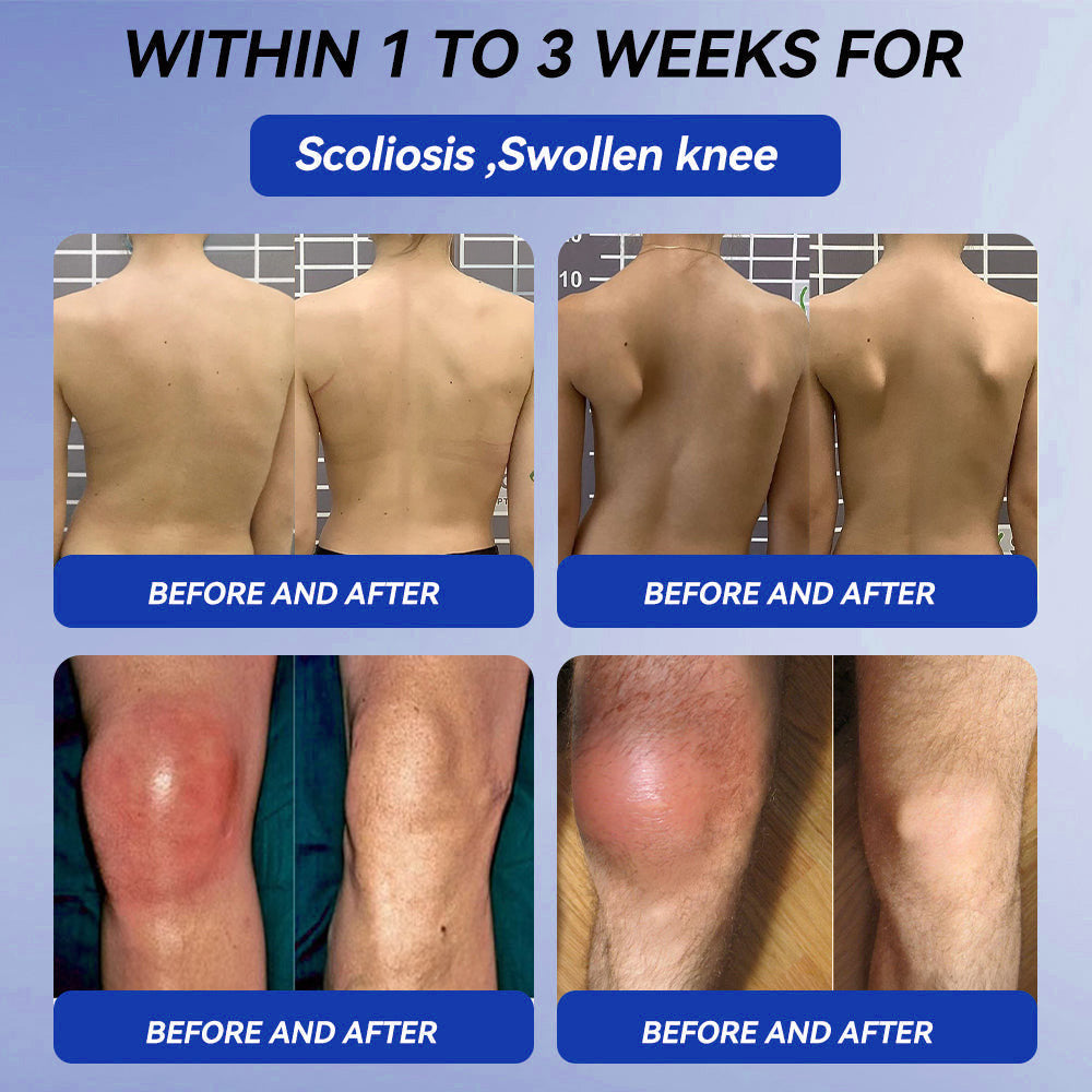 𝒞𝓇𝑜𝒶𝒾𝑒® BPC-157 + TB-500 Rapid-Release Oral Patch 🦴 Fast-Acting Pain Relief for Arthritis. Nerves & Sports Injuries