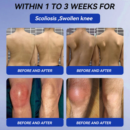 𝒞𝓇𝑜𝒶𝒾𝑒® BPC-157 + TB-500 Rapid-Release Oral Patch 🦴 Fast-Acting Pain Relief for Arthritis. Nerves & Sports Injuries