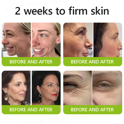 Official Store | Rejuvenate Your Skin Instantly 💫 STDEI® BOTOX & VITA A RETINOL SHOT Anti-Wrinkle Lifting & Firming Cream