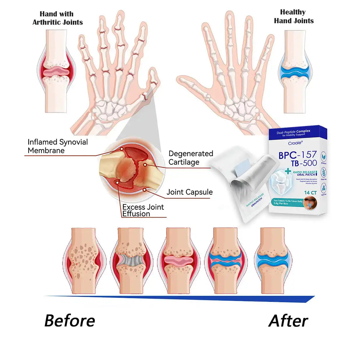 𝒞𝓇𝑜𝒶𝒾𝑒® BPC-157 + TB-500 Rapid-Release Oral Patch 🦴 Fast-Acting Pain Relief for Arthritis. Nerves & Sports Injuries
