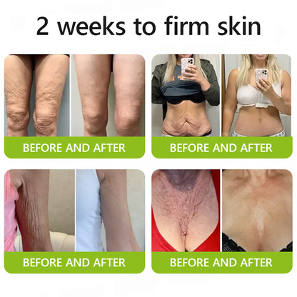 Official Store | Rejuvenate Your Skin Instantly 💫 STDEI® BOTOX & VITA A RETINOL SHOT Anti-Wrinkle Lifting & Firming Cream