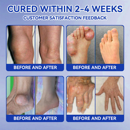 𝒞𝓇𝑜𝒶𝒾𝑒® BPC-157 + TB-500 Rapid-Release Oral Patch 🦴 Fast-Acting Pain Relief for Arthritis. Nerves & Sports Injuries