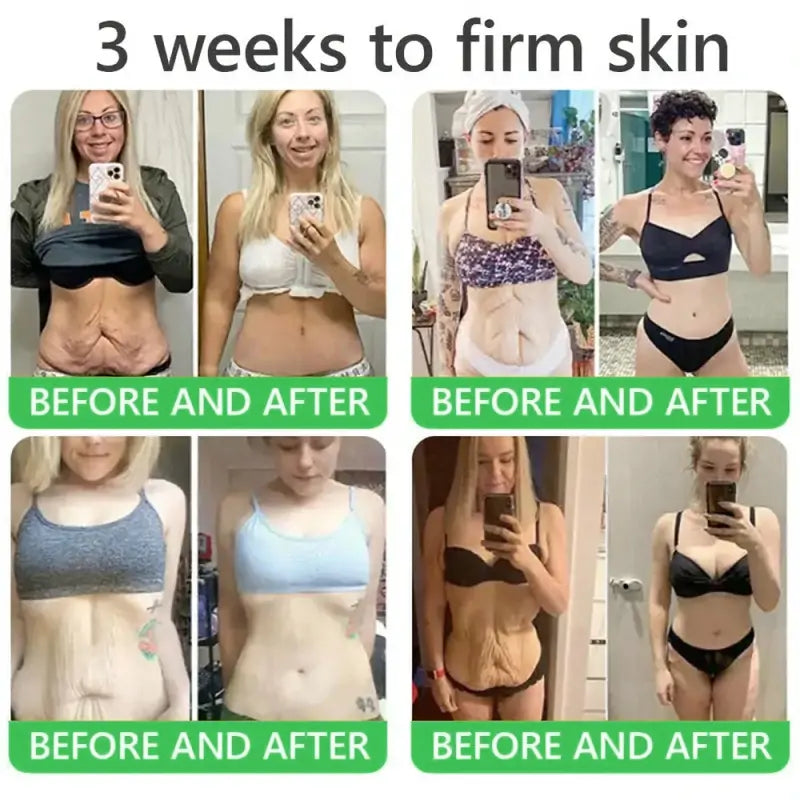 𝐎𝐫𝐢𝐚𝐜𝐡® 𝐀𝟏𝟎+ 𝟔-𝐢𝐧-𝟏 𝐃𝐞𝐫𝐦𝐚𝐑𝐞𝐩𝐚𝐢𝐫 𝐒𝐞𝐫𝐮𝐦 💧 𝐅𝐃𝐀 𝐂𝐞𝐫𝐭𝐢𝐟𝐢𝐞𝐝 🇺🇸 – 𝐅𝐢𝐫𝐦𝐬 𝐥𝐨𝐨𝐬𝐞 𝐬𝐤𝐢𝐧 💪, 𝐟𝐚𝐝𝐞𝐬 𝐛𝐫𝐮𝐢𝐬𝐢𝐧𝐠 💜 𝐚𝐧𝐝 𝐬𝐞𝐧𝐢𝐥𝐞 𝐩𝐮𝐫𝐩𝐮𝐫𝐚, 𝐚𝐧𝐝 𝐢𝐦𝐩𝐫𝐨𝐯𝐞𝐬 𝐤𝐞𝐫𝐚𝐭𝐢𝐧 𝐛𝐮𝐢𝐥𝐝𝐮𝐩, 𝐬𝐞𝐛𝐨𝐫𝐫𝐡𝐞𝐢𝐜 𝐝𝐞𝐫𝐦𝐚𝐭𝐢𝐭𝐢𝐬, 𝐚𝐧𝐝 𝐟𝐨𝐥𝐥𝐢𝐜𝐮𝐥𝐚𝐫 𝐤𝐞𝐫𝐚𝐭𝐨𝐬𝐢𝐬 ✨