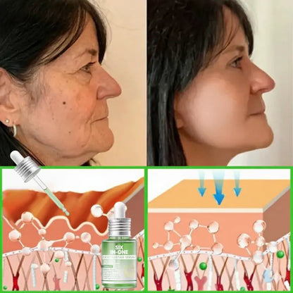 𝐎𝐫𝐢𝐚𝐜𝐡® 𝐀𝟏𝟎+ 𝟔-𝐢𝐧-𝟏 𝐃𝐞𝐫𝐦𝐚𝐑𝐞𝐩𝐚𝐢𝐫 𝐒𝐞𝐫𝐮𝐦 💧 𝐅𝐃𝐀 𝐂𝐞𝐫𝐭𝐢𝐟𝐢𝐞𝐝 🇺🇸 – 𝐅𝐢𝐫𝐦𝐬 𝐥𝐨𝐨𝐬𝐞 𝐬𝐤𝐢𝐧 💪, 𝐟𝐚𝐝𝐞𝐬 𝐛𝐫𝐮𝐢𝐬𝐢𝐧𝐠 💜 𝐚𝐧𝐝 𝐬𝐞𝐧𝐢𝐥𝐞 𝐩𝐮𝐫𝐩𝐮𝐫𝐚, 𝐚𝐧𝐝 𝐢𝐦𝐩𝐫𝐨𝐯𝐞𝐬 𝐤𝐞𝐫𝐚𝐭𝐢𝐧 𝐛𝐮𝐢𝐥𝐝𝐮𝐩, 𝐬𝐞𝐛𝐨𝐫𝐫𝐡𝐞𝐢𝐜 𝐝𝐞𝐫𝐦𝐚𝐭𝐢𝐭𝐢𝐬, 𝐚𝐧𝐝 𝐟𝐨𝐥𝐥𝐢𝐜𝐮𝐥𝐚𝐫 𝐤𝐞𝐫𝐚𝐭𝐨𝐬𝐢𝐬 ✨