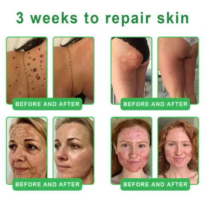 𝐎𝐫𝐢𝐚𝐜𝐡® 𝐀𝟏𝟎+ 𝟔-𝐢𝐧-𝟏 𝐃𝐞𝐫𝐦𝐚𝐑𝐞𝐩𝐚𝐢𝐫 𝐒𝐞𝐫𝐮𝐦 💧 𝐅𝐃𝐀 𝐂𝐞𝐫𝐭𝐢𝐟𝐢𝐞𝐝 🇺🇸 – 𝐅𝐢𝐫𝐦𝐬 𝐥𝐨𝐨𝐬𝐞 𝐬𝐤𝐢𝐧 💪, 𝐟𝐚𝐝𝐞𝐬 𝐛𝐫𝐮𝐢𝐬𝐢𝐧𝐠 💜 𝐚𝐧𝐝 𝐬𝐞𝐧𝐢𝐥𝐞 𝐩𝐮𝐫𝐩𝐮𝐫𝐚, 𝐚𝐧𝐝 𝐢𝐦𝐩𝐫𝐨𝐯𝐞𝐬 𝐤𝐞𝐫𝐚𝐭𝐢𝐧 𝐛𝐮𝐢𝐥𝐝𝐮𝐩, 𝐬𝐞𝐛𝐨𝐫𝐫𝐡𝐞𝐢𝐜 𝐝𝐞𝐫𝐦𝐚𝐭𝐢𝐭𝐢𝐬, 𝐚𝐧𝐝 𝐟𝐨𝐥𝐥𝐢𝐜𝐮𝐥𝐚𝐫 𝐤𝐞𝐫𝐚𝐭𝐨𝐬𝐢𝐬 ✨