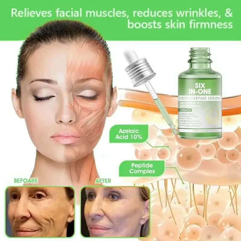 𝐎𝐫𝐢𝐚𝐜𝐡® 𝐀𝟏𝟎+ 𝟔-𝐢𝐧-𝟏 𝐃𝐞𝐫𝐦𝐚𝐑𝐞𝐩𝐚𝐢𝐫 𝐒𝐞𝐫𝐮𝐦 💧 𝐅𝐃𝐀 𝐂𝐞𝐫𝐭𝐢𝐟𝐢𝐞𝐝 🇺🇸 – 𝐅𝐢𝐫𝐦𝐬 𝐥𝐨𝐨𝐬𝐞 𝐬𝐤𝐢𝐧 💪, 𝐟𝐚𝐝𝐞𝐬 𝐛𝐫𝐮𝐢𝐬𝐢𝐧𝐠 💜 𝐚𝐧𝐝 𝐬𝐞𝐧𝐢𝐥𝐞 𝐩𝐮𝐫𝐩𝐮𝐫𝐚, 𝐚𝐧𝐝 𝐢𝐦𝐩𝐫𝐨𝐯𝐞𝐬 𝐤𝐞𝐫𝐚𝐭𝐢𝐧 𝐛𝐮𝐢𝐥𝐝𝐮𝐩, 𝐬𝐞𝐛𝐨𝐫𝐫𝐡𝐞𝐢𝐜 𝐝𝐞𝐫𝐦𝐚𝐭𝐢𝐭𝐢𝐬, 𝐚𝐧𝐝 𝐟𝐨𝐥𝐥𝐢𝐜𝐮𝐥𝐚𝐫 𝐤𝐞𝐫𝐚𝐭𝐨𝐬𝐢𝐬 ✨