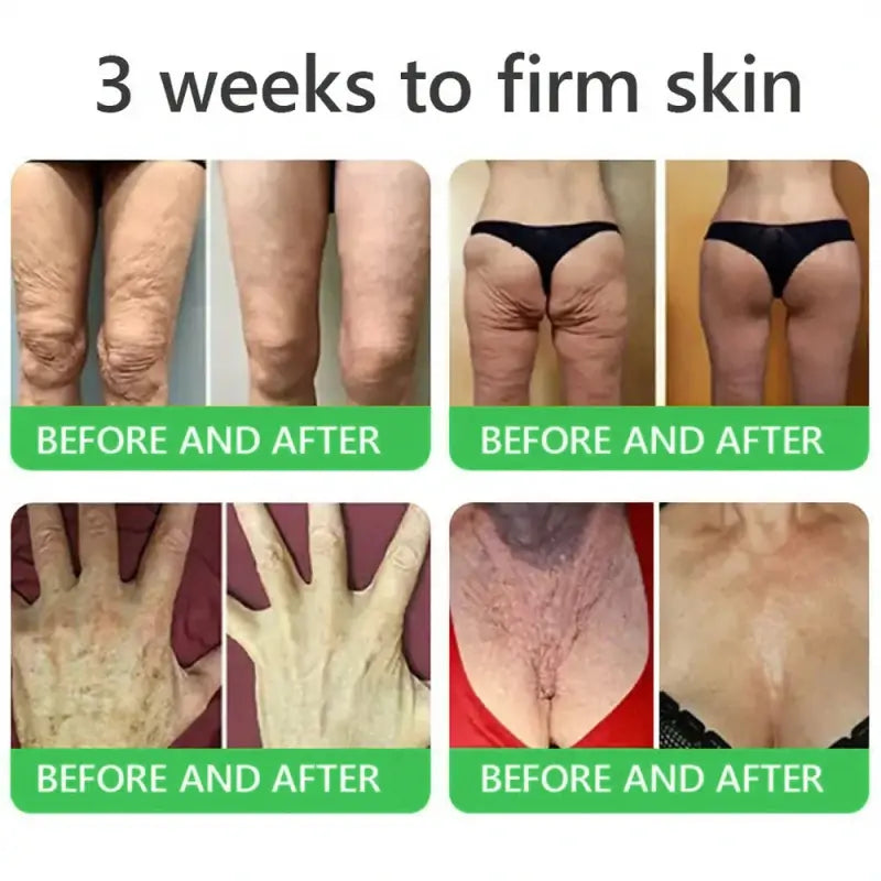 𝐎𝐫𝐢𝐚𝐜𝐡® 𝐀𝟏𝟎+ 𝟔-𝐢𝐧-𝟏 𝐃𝐞𝐫𝐦𝐚𝐑𝐞𝐩𝐚𝐢𝐫 𝐒𝐞𝐫𝐮𝐦 💧 𝐅𝐃𝐀 𝐂𝐞𝐫𝐭𝐢𝐟𝐢𝐞𝐝 🇺🇸 – 𝐅𝐢𝐫𝐦𝐬 𝐥𝐨𝐨𝐬𝐞 𝐬𝐤𝐢𝐧 💪, 𝐟𝐚𝐝𝐞𝐬 𝐛𝐫𝐮𝐢𝐬𝐢𝐧𝐠 💜 𝐚𝐧𝐝 𝐬𝐞𝐧𝐢𝐥𝐞 𝐩𝐮𝐫𝐩𝐮𝐫𝐚, 𝐚𝐧𝐝 𝐢𝐦𝐩𝐫𝐨𝐯𝐞𝐬 𝐤𝐞𝐫𝐚𝐭𝐢𝐧 𝐛𝐮𝐢𝐥𝐝𝐮𝐩, 𝐬𝐞𝐛𝐨𝐫𝐫𝐡𝐞𝐢𝐜 𝐝𝐞𝐫𝐦𝐚𝐭𝐢𝐭𝐢𝐬, 𝐚𝐧𝐝 𝐟𝐨𝐥𝐥𝐢𝐜𝐮𝐥𝐚𝐫 𝐤𝐞𝐫𝐚𝐭𝐨𝐬𝐢𝐬 ✨