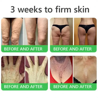 𝐎𝐫𝐢𝐚𝐜𝐡® 𝐀𝟏𝟎+ 𝟔-𝐢𝐧-𝟏 𝐃𝐞𝐫𝐦𝐚𝐑𝐞𝐩𝐚𝐢𝐫 𝐒𝐞𝐫𝐮𝐦 💧 𝐅𝐃𝐀 𝐂𝐞𝐫𝐭𝐢𝐟𝐢𝐞𝐝 🇺🇸 – 𝐅𝐢𝐫𝐦𝐬 𝐥𝐨𝐨𝐬𝐞 𝐬𝐤𝐢𝐧 💪, 𝐟𝐚𝐝𝐞𝐬 𝐛𝐫𝐮𝐢𝐬𝐢𝐧𝐠 💜 𝐚𝐧𝐝 𝐬𝐞𝐧𝐢𝐥𝐞 𝐩𝐮𝐫𝐩𝐮𝐫𝐚, 𝐚𝐧𝐝 𝐢𝐦𝐩𝐫𝐨𝐯𝐞𝐬 𝐤𝐞𝐫𝐚𝐭𝐢𝐧 𝐛𝐮𝐢𝐥𝐝𝐮𝐩, 𝐬𝐞𝐛𝐨𝐫𝐫𝐡𝐞𝐢𝐜 𝐝𝐞𝐫𝐦𝐚𝐭𝐢𝐭𝐢𝐬, 𝐚𝐧𝐝 𝐟𝐨𝐥𝐥𝐢𝐜𝐮𝐥𝐚𝐫 𝐤𝐞𝐫𝐚𝐭𝐨𝐬𝐢𝐬 ✨